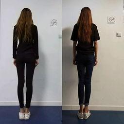 xo型腿视频,跟随专业视频教程，轻松改善腿部线条